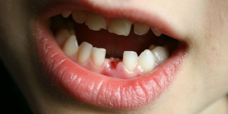 Mơ rụng răng ra máu nhưng tiền chảy thành dòng – điềm bù đắp hoàn hảo